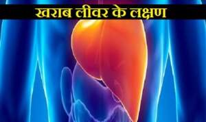 खराब लीवर के लक्षण